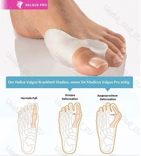 Hallux Valgus Schiene Medicus