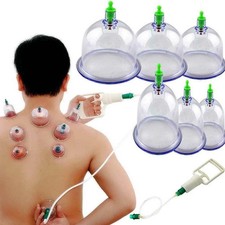 Cups+Suction Pump SET body