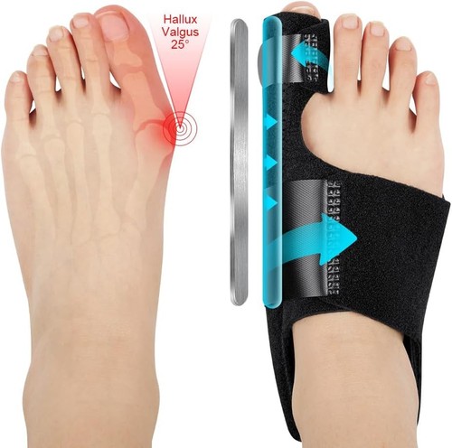 Hallux valgus korrektur - hallux,