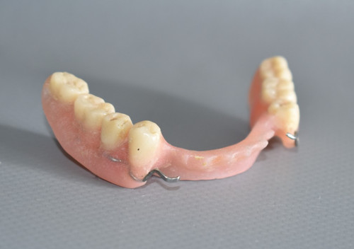 Lehrmodell zahnprothese - lehrmodell,