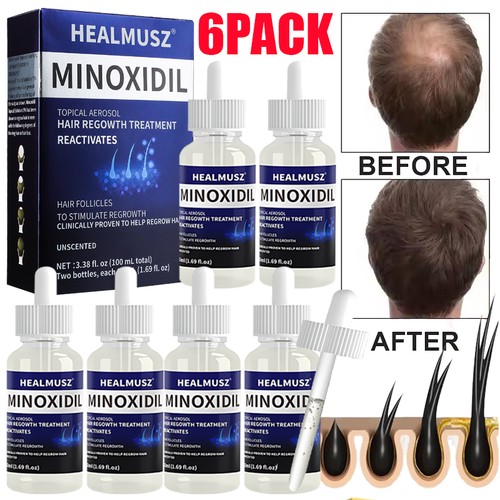 Extra starke minoxidil - 6x,
