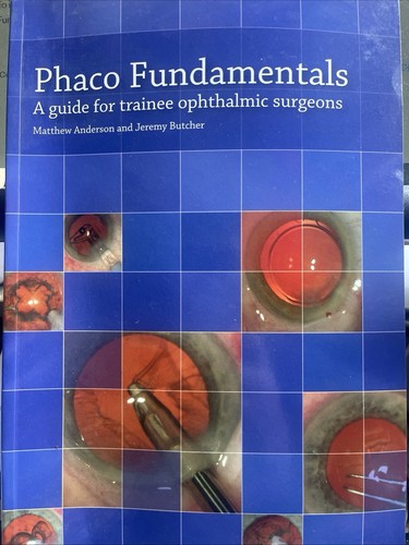 Phaco fundamentals guide - phaco, a