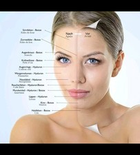 Premium Produkte Botox Falten