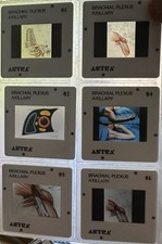 Astra Pharmaceutical Brachial