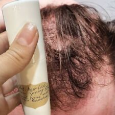 Natürliches schnelles Haarwachstum dichtes Nachwachsen hausgemachtes Serum Anti-Verlust Behandlung Spray