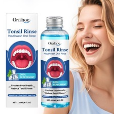 Tonsil stone remover - remover, mouthwash