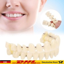 Snap On Veneers Kosmetische