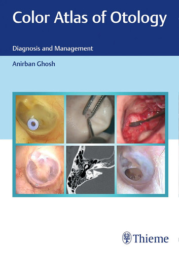 Color atlas otology - atlas, of