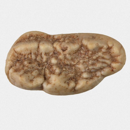 Oberkiefer molar u - molar,