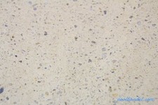 Pool Beckenrandsteine