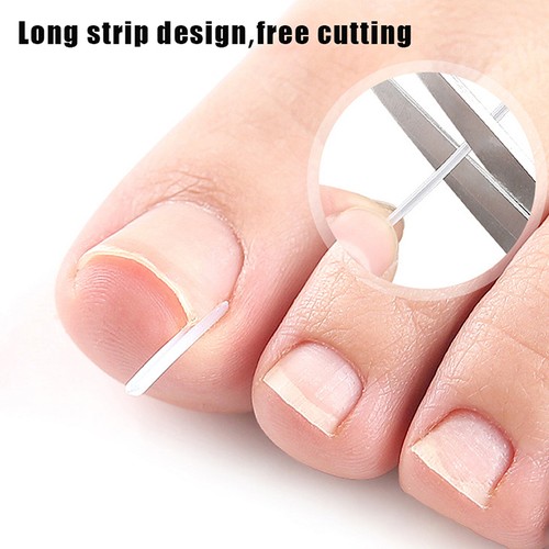 100cm length ingrown - length,