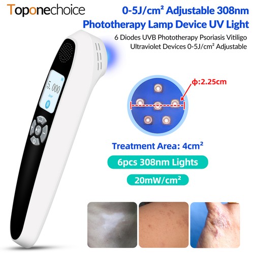 Uvb 308nm phototherapie lampe - uvb,
