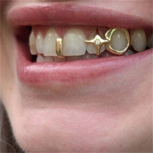 Zähne grillz hip - grillz, gold