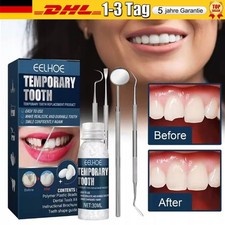 Provisorischer Zahnersatz Set