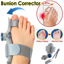 Hallux valgus korrektur - hallux,
