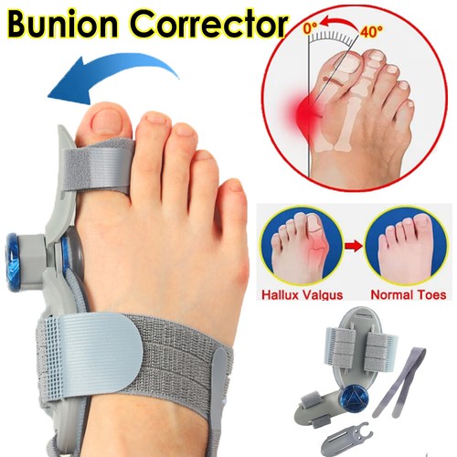 Hallux valgus korrektur - hallux,