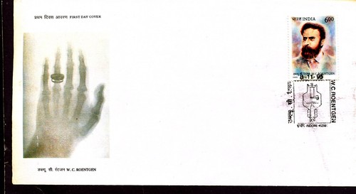 Rontgen ray radiology health - rontgen,