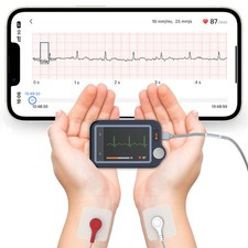 EKG Gerät für zuhause mit Externes Kabel 30s/ 60s/5min Aufzeichnung + KI-Analyse