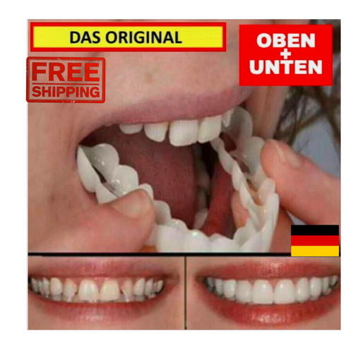 Snap veneers kosmetische - snap,