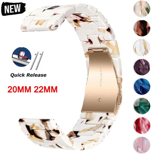 18mm 20mm 22mm ersatz armband - 18mm/20mm/22mm,