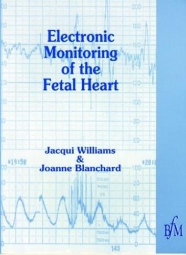 Electronic monitoring fetal - monitoring, of