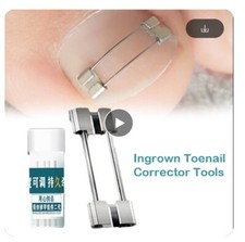 SCHÖNHEIT GESUNDHEIT INSTRUMENTE BEHANDLUNG RESTAURIERUNG FÜßE eingewachsene Nägel Pediküre