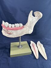 Vintage SOMSO Unterkiefer - Dental Study Material - Old anatomical Jaw