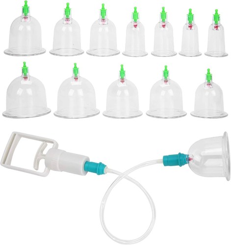 Schröpfgläser set mit - schröpfgläser,