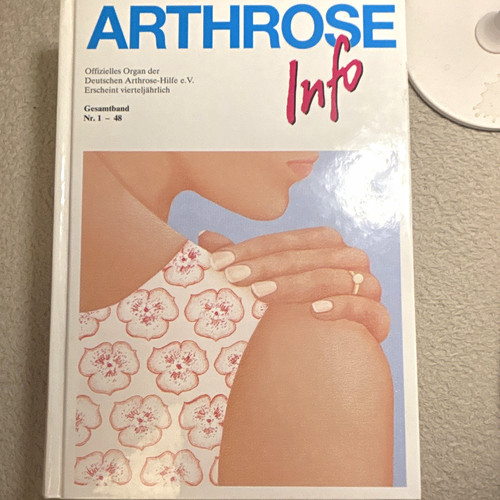 Buch arthrose info - buch, gesamtband