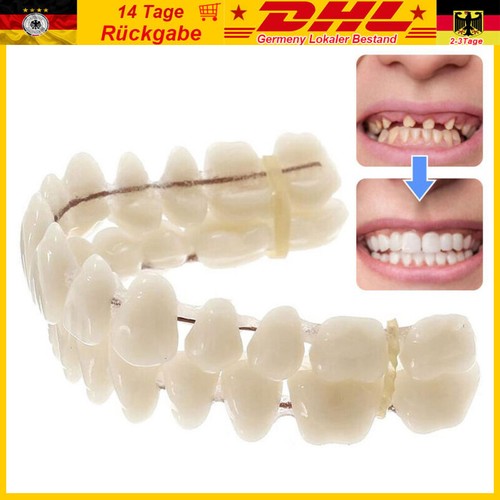 Snap veneers kosmetische - veneers,