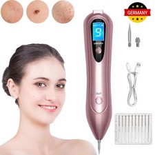 Muttermal Entfernen Stift