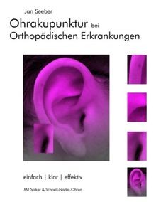 Ohrakupunktur bei