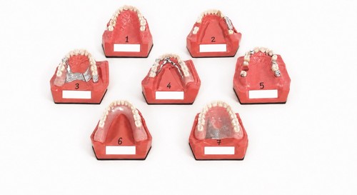 Dent dental schaumodelle - dent,