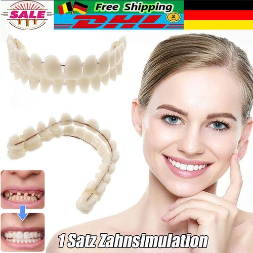 Snap veneers kosmetische - snap,