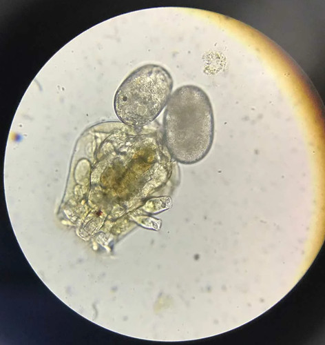 Rotifer dauerzysten set - rotifer-dauerzysten, (7