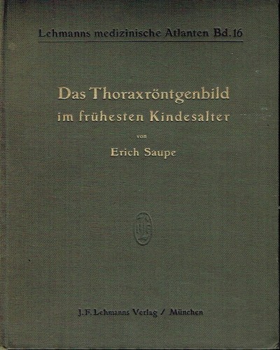 Saupe thoraxröntgenbild - thoraxröntgenbild, im