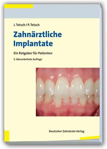Zahnärztliche implantate - zahnärztliche,