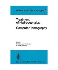 Treatment of Hydrocephalus