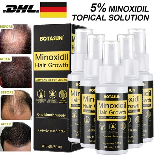 Minoxidil haarwachstum - 5%,