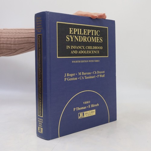 Epileptic syndromes - epileptic,