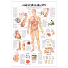 Anatomische Lehrtafel "Diabetes Mellitus", LxB 100x70 cm