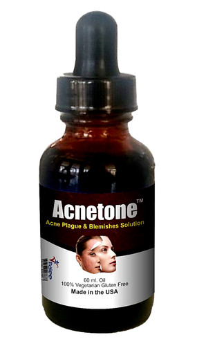 Acnetone vitalee anti akne - vitalee, anti-akne