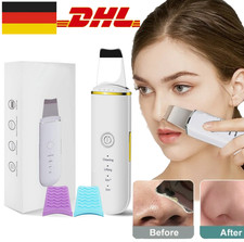 Ultraschallpeelinggerät