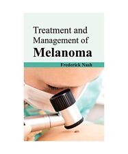 Treatment and Management of Melanoma