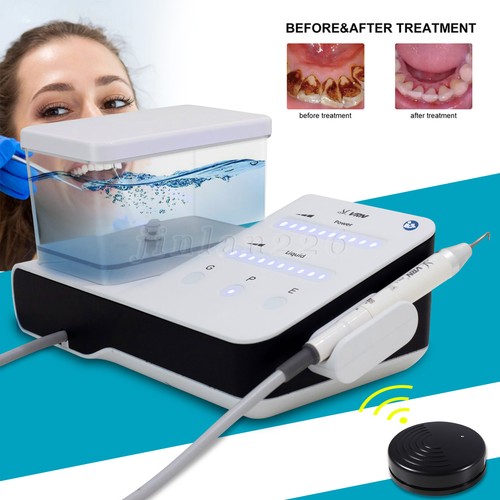110v 220v ultraschall - 110v/220v, ultraschall-scaler