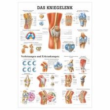 Das Kniegelenk Lehrtafel