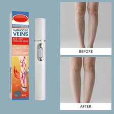 Krampfadern Behandlungsgerät