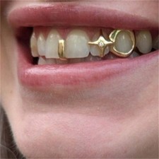 Zähne Grillz Hip Hop Gold