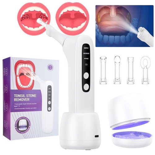 Electric vacuum tonsil stone - electric,