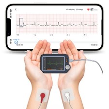 Chckme EX EKG Gerät für